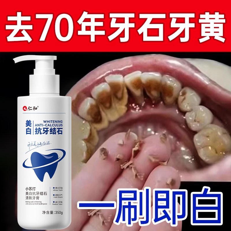 【仁和药业】美白去黄抗牙结石