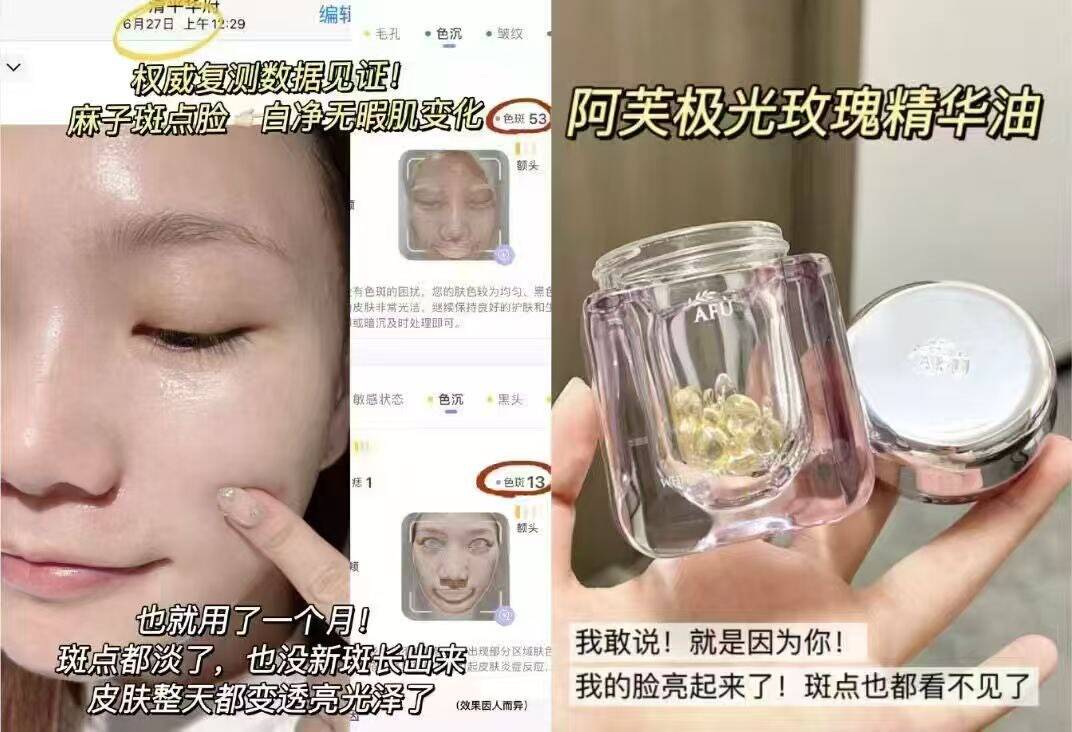 6790粒阿芙精油大papi酱/何超莲都在用同款一颗=舒缓 d斑 抗氧https://p.pinduoduo.com/F528KBKS?sc=EFAC